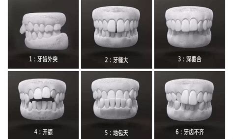 郑州牙齿矫正丨错颌畸形的危害性 知乎