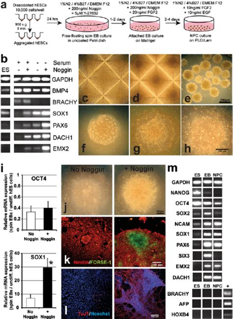 Generation Of Forebrain Neural Precursors From HES Cells A