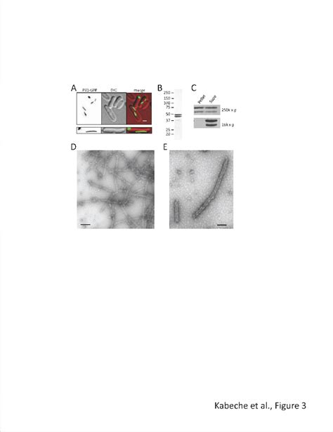 Figure 1 From The Filament Forming Protein Pil1 Assembles Linear