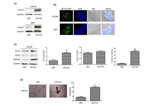 [보고서]cd133 Prostate Cancer Stem Like Cell의 골수내 미세환경에서 골형성 및 골용해 조절에 관한 연구