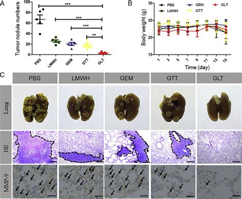 In Vivo Anti Metastasis Treatment A The Number Of 4t1 Metastases