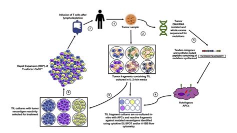 Adoptive T Cell Therapy For Solid Malignancies Surgical Oncology Clinics