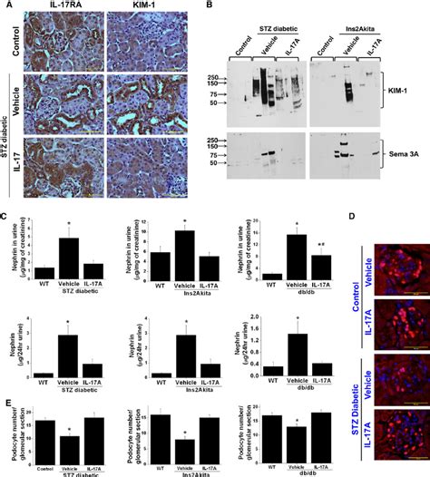 Il 17 Receptor A Il 17ra Podocyte And Tubular Injury Marker