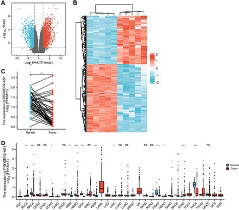 Comprehensive Analysis Of The PROSER2 AS1 And CeRNAnetwork IJGM