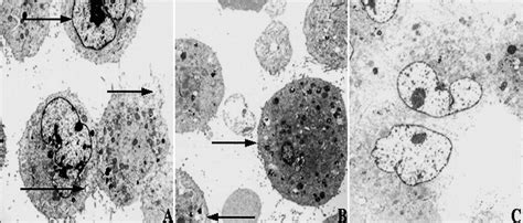 Em Of Human Adipose Cells Sw Infected With M Ulcerans For H