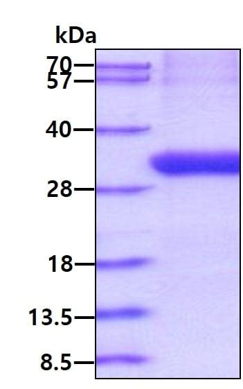 Recombinant Human C Binding Protein C Bpb Ab Abcam