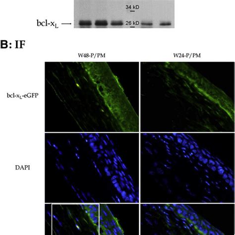 Of Mrna Levels Of Bax And Bcl X L In Normal And Epithelial Debridement