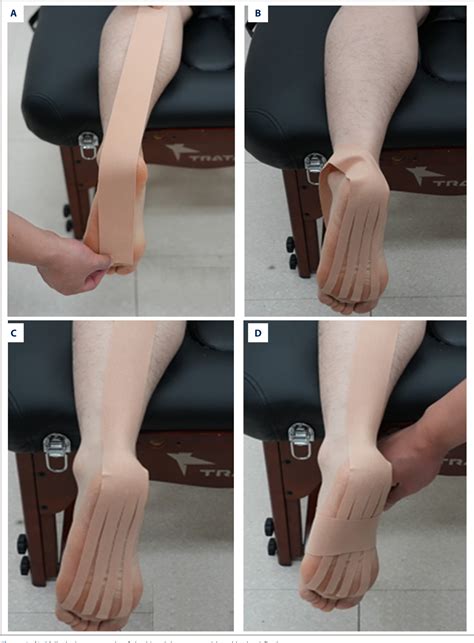 Figure 2 From Effect Of Dynamic Taping Versus Kinesiology Taping On