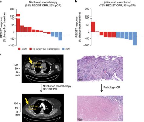 Radiographic And Pathologic Responses To Neoadjuvant Nivolumab And The Download Scientific