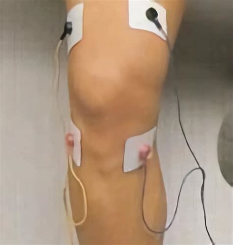 Colocar Electrodos En Rodilla Alivio Del Dolor Con Terapia Tens