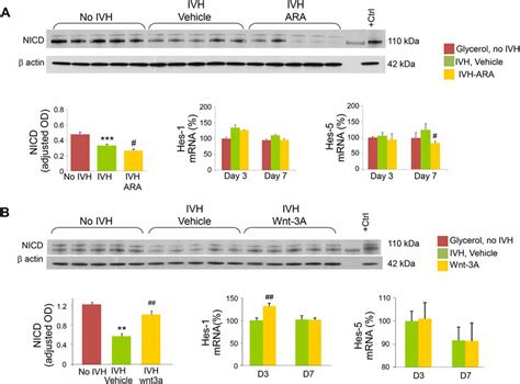 Gsk Inhibition By Ar A Suppresses And Wnt A Treatment Enhances