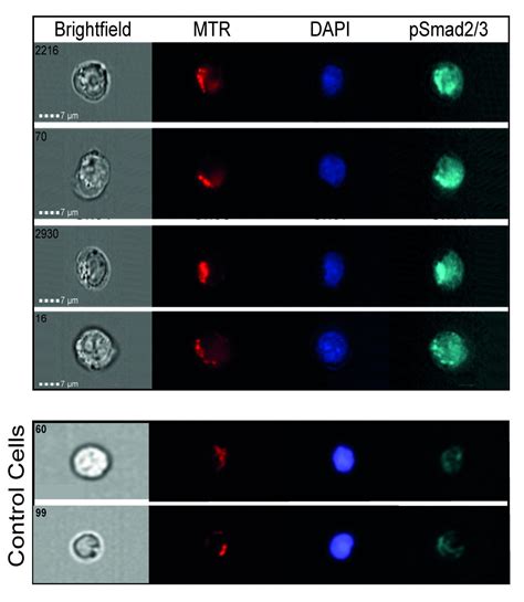 How A Two Faced Protein Protects Tumors From Eurekalert