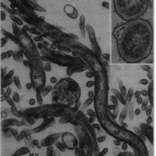 Electron Micrograph Of A Capillary In The Adult Murine Blood Brain