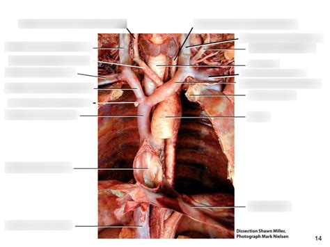 Thoracic Cavity Anterior View Diagram Quizlet