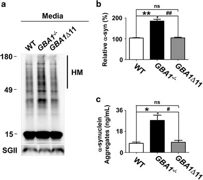 Secretion of α synuclein aggregates a Western blot analysis of