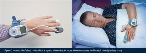 Snoring Sleep Apnoea Treatment Dr Gan Singapore