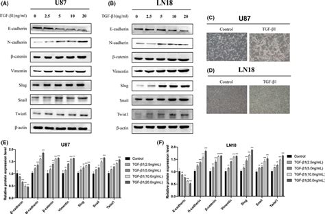 A B Glioma U87 and LN18 cells were treated with TGFβ1 for 48 h to