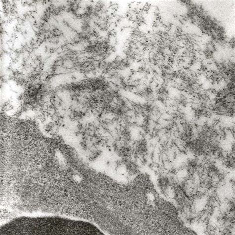 Transmission Electron Microscopy Of Immunogold Labelled Vascular