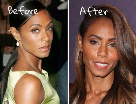 Jada Pinkett Smith before and after plastic surgery pictures