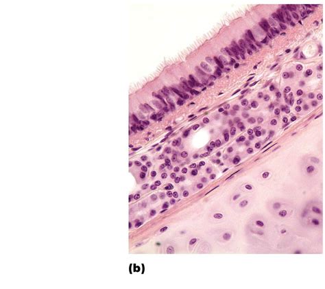 Photomicrograph Of Tracheal Wall Diagram Quizlet