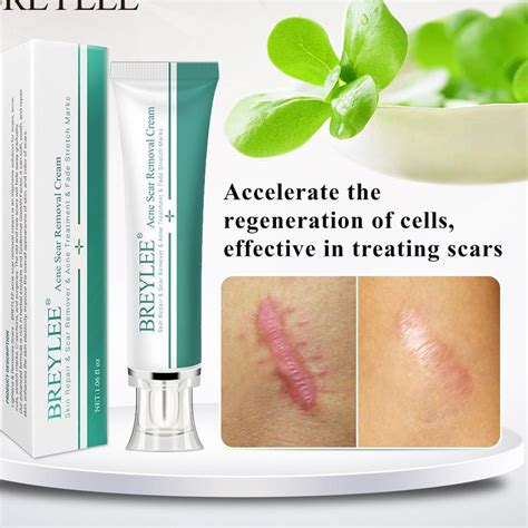 Jual Real Produk BREYLEE Acne Scar Removal Cream Skin Repair Scar Acne