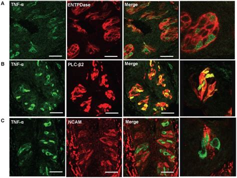 Confocal images of double immunofluorescent staining of TNF α green