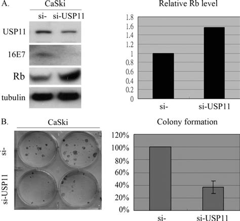 Usp11 Stabilizes Hpv 16e7 And Further Modulates The E7 Biological