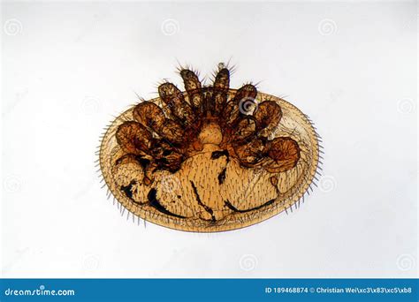 A Varroa Mite, Varroa Destructor, Under the Microscope Stock Photo ...