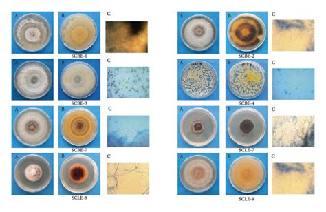 Morphological Identification Of Isolated Fungi A Front View B Download Scientific Diagram