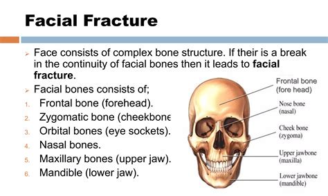 Cranial and facial fractures | PPTX
