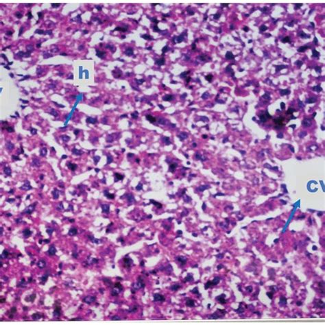 A Photomicrograph Of Liver Section Obtained From Normal Adult Male