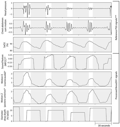 An Example Of Extracted Features From BresoDX1 Recordings Compared To