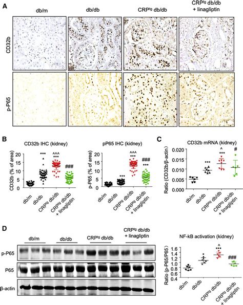 Linagliptin Effectively Blocks DPP4 CD32b NF KB Signaling Circuit In