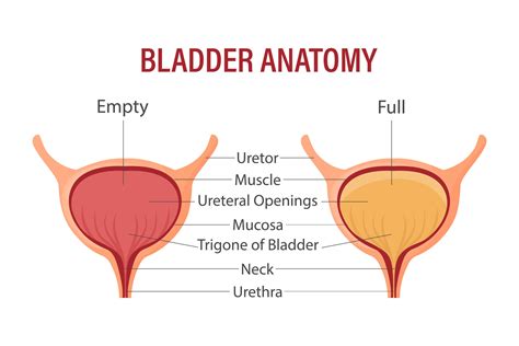 Full and empty bladder. Urinary bladder with urine. Anatomy of the ...