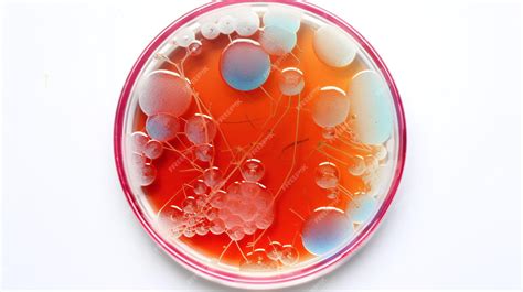 Premium Photo | Bacteria in a petri dish