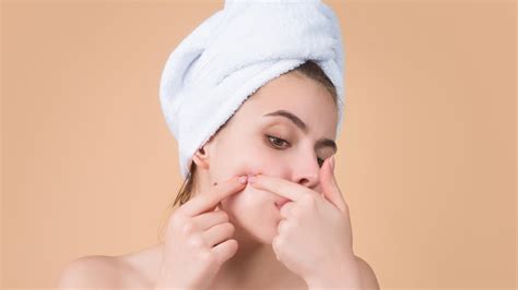 5 Easy Home Remedies To Remove Blackheads On Cheeks Healthshots