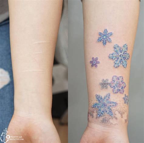 30+ Beautiful Scar-Concealing Tattoo Designs - TattooBlend