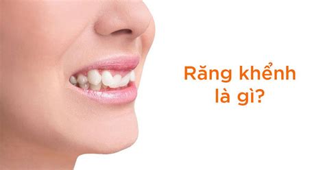 rang khenh  ben xau hay dep  nen nieng rang