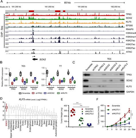 Tp63 Sox2 And Klf5 Establish Core Regulatory Circuitry And Construct