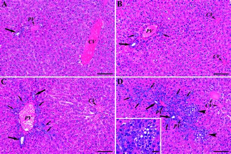 Histological Characteristics Of The Livers After Aaf Ca Treatment He