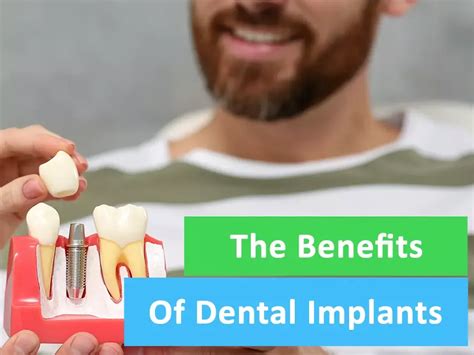 Dental Implants Atlantic Dental Group CA