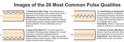 Pulse Diagnosis Acupuncture Poster 24 X 36