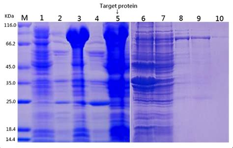 Sds Page Pattern Of The Samples Note M Protein Marker The Total