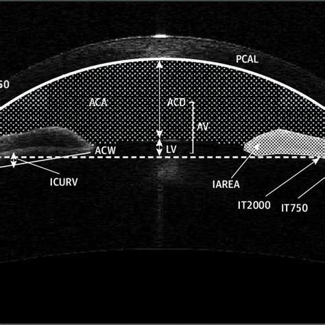 Anterior Segment Optical Coherence Tomography Image Showing The Download Scientific Diagram