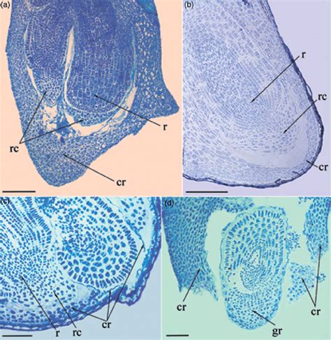 Structural peculiarities of coleorhiza of Steptoe (a) and AZ34 (b-d ...