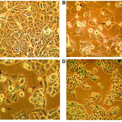 Morphology Of Untreated Mcf 7 Cells A As Viewed Using Inverted Phase Download Scientific