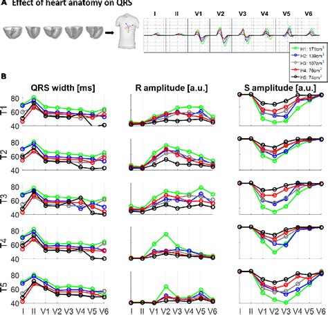 Figure 3 From MRI Based Computational Torso Biventricular Multiscale