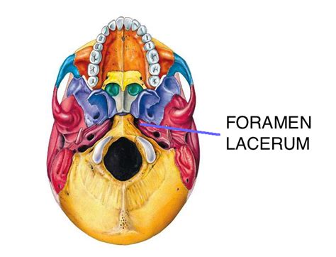 Foramen Lacerum Anatomy Clinical Significance Disorders