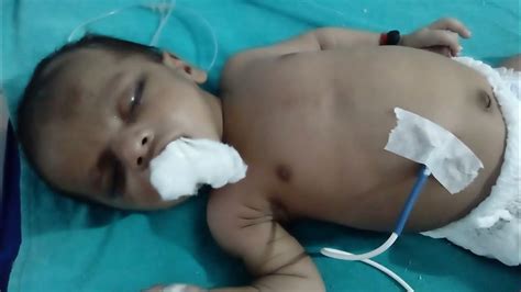 newborn baby    birth full  vernix caseosa newborn