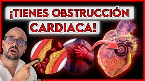 7 SÍNTOMAS de OBSTRUCCIÓN de ARTERIAS CARDIACAS AVISAN de un